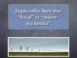 Taquicardia Auricular:
  “focal” vs “macro -
      reentrada”
 