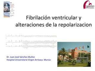 Fibrilación ventricular y
         alteraciones de la repolarizacion




Dr. Juan José Sánchez Muñoz
Hospital Universitario Virgen Arrixaca. Murcia
 
