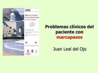 Problemas clínicos del
    paciente con
     marcapasos

   Juan Leal del Ojo
 