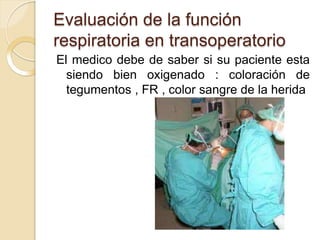 Evaluación de la función
respiratoria en transoperatorio
El medico debe de saber si su paciente esta
siendo bien oxigenado : coloración de
tegumentos , FR , color sangre de la herida
 