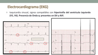 Electrocardiograma (EKG)
 taquicardia sinusal, signos compatibles con hipertrofia del ventrículo izquierdo
(V5, V6). Presencia de Onda q: presentes en DII y AVF.
 