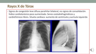Rayos X de Tórax
• Signos de congestión leve difusa parahiliar bilateral, no signos de consolidación.
Índice cardiotorácico poco aumentado. Senos costodiafragmáticos y
cardiofrénicos libres. Silueta cardíaca: aumento de ventrículo y aurícula izquierda
 