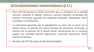 ECOCARDIOGRAMA TRANSTORÁXICO (E.T.T.)
 Flujo anormal durante la sístole ventricular que se introducía en la cavidad
auricular izquierda al Doppler continuo. Aurícula izquierda aumentada de
volumen. Ventrículo izquierdo con moderada dilatación. Valvulopatía mitral
reumática, sin calcificación.
 La turbulencia generada por la regurgitación se inicia con el cierre de la
válvula mitral, se extiende por todo el período de contracción ventricular, y
termina con la apertura de la válvula mitral. Acortamiento de un músculo
papilar con motilidad parietal segmentaria ventricular disminuida. Otras
válvulas no lesiones.
 No signos de HTP. No signos de derrame pericárdico.
 