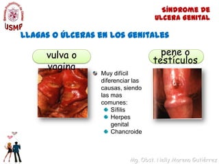 Síndrome de Ulcera GenitalLlagas o úlceras en los genitalesvulva o vaginapene o testículosMuy difícil diferenciar las causas, siendo las mas comunes:SífilisHerpes genitalChancroide