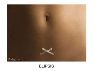 ELIPSIS 