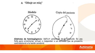 Síndrome de heminegligencia: Déficit unilateral de la atención. Es una
falla para orientarse, actuar o responder a un estímulo que se presenta
contralateral a la lesión cerebral.
 