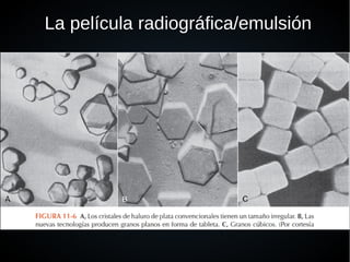La película radiográfica/emulsión
 