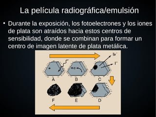 La película radiográfica/emulsión
●
Durante la exposición, los fotoelectrones y los iones
de plata son atraídos hacia estos centros de
sensibilidad, donde se combinan para formar un
centro de imagen latente de plata metálica.
 
