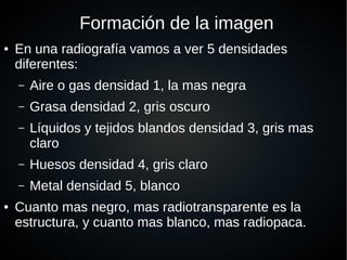 Formación de la imagen
● En una radiografía vamos a ver 5 densidades
diferentes:
– Aire o gas densidad 1, la mas negra
– Grasa densidad 2, gris oscuro
– Líquidos y tejidos blandos densidad 3, gris mas
claro
– Huesos densidad 4, gris claro
– Metal densidad 5, blanco
● Cuanto mas negro, mas radiotransparente es la
estructura, y cuanto mas blanco, mas radiopaca.
 