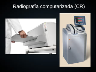 ●
Radiografía computarizada (CR)
 