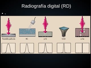 ●
Radiografía digital (RD)
●
-
 