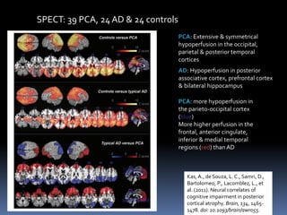 PCA: Extensive & symmetrical
hypoperfusion in the occipital,
parietal & posterior temporal
cortices
AD: Hypoperfusion in posterior
associative cortex, prefrontal cortex
& bilateral hippocampus
Kas, A., de Souza, L. C., Samri, D.,
Bartolomeo, P., Lacomblez, L., et
al. (2011). Neural correlates of
cognitive impairment in posterior
cortical atrophy. Brain, 134, 1465-
1478. doi: 10.1093/brain/awr055.
SPECT: 39 PCA, 24 AD & 24 controls
PCA: more hypoperfusion in
the parieto-occipital cortex
(blue)
More higher perfusion in the
frontal, anterior cingulate,
inferior & medial temporal
regions (red) than AD
 