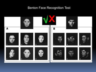 Benton Face Recognition Test
 