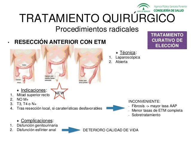 C ncer Rectal diagn stico Y Manejo Carmen Molina R2 Dig c-ncer-rectal-diagn-stico-y-manejo-carmen-molina-r2-dig