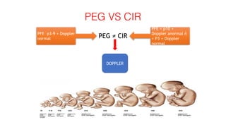 PEG VS CIR
PEG ≠ CIR
DOPPLER
PFE p3-9 + Doppler
normal
PFE < p10 +
Doppler anormal ó
< P3 + Doppler
normal
 