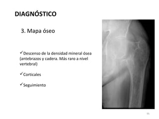 3. Mapa óseo
DIAGNÓSTICO
Descenso de la densidad mineral ósea
(antebrazos y cadera. Más raro a nivel
vertebral)
Corticales
Seguimiento
95
 