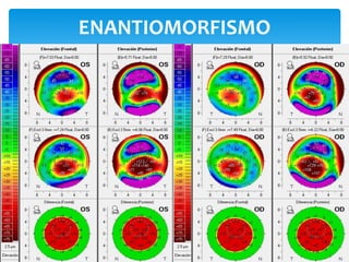 ENANTIOMORFISMO
 