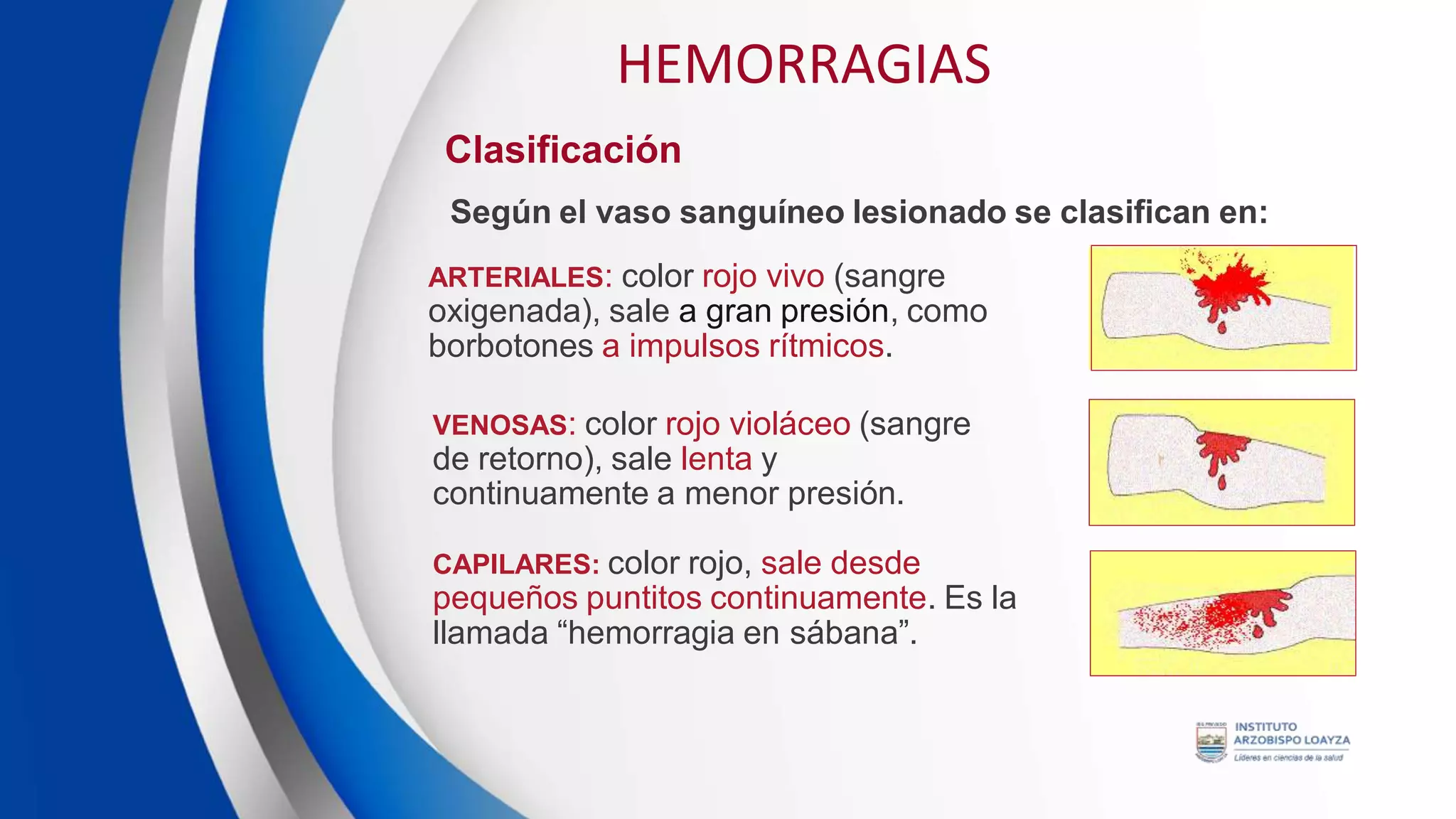 SESION DE APRENDIZAJE 8 - HEMORRAGIAS.pdf