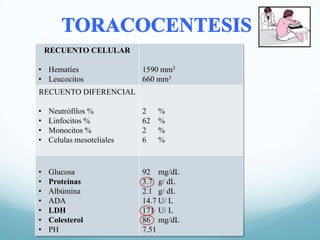 RECUENTO CELULAR
• Hematíes
• Leucocitos

1590 mm3
660 mm3

RECUENTO DIFERENCIAL
•
•
•
•

Neutrófilos %
Linfocitos %
Monocitos %
Celulas mesoteliales

2
62
2
6

•
•
•
•
•
•
•

Glucosa
Proteínas
Albúmina
ADA
LDH
Colesterol
PH

92 mg/dL
3.7 g/ dL
2.1 g/ dL
14.7 U/ L
171 U/ L
86 mg/dL
7.51

%
%
%
%

 