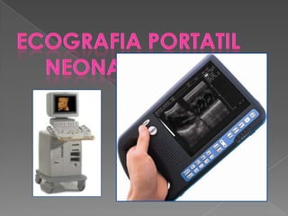 Ecografiaportatil  neonatología 