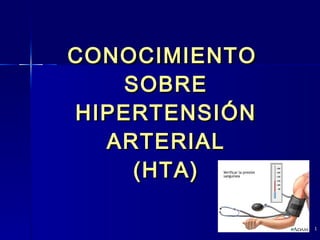CONOCIMIENTO  SOBRE HIPERTENSIÓN ARTERIAL (HTA) 