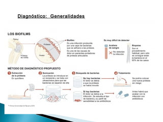 Diagnóstico: Generalidades
 Fiebre: aparece en menos de la mitad de los casos. Es un signo muy
inespecífico.
Signos inflamatorios locales: eritema, calor, tumefaccion…tienen valor
cuando se presentan como una manifestación tardía no en el
postoperaotorio.
 Parametros de laboratorio: leucocitosis, PCR, VSG elevada.
(inespecificos)
 Artrocentesis: leucocitos, neutrófilos.
 Cultivo muestra tisular o LS: *retirar atb 2 semanas antes, 1 cultivo + (S.
aureus, Pseudomonas).
Examen histológico
 