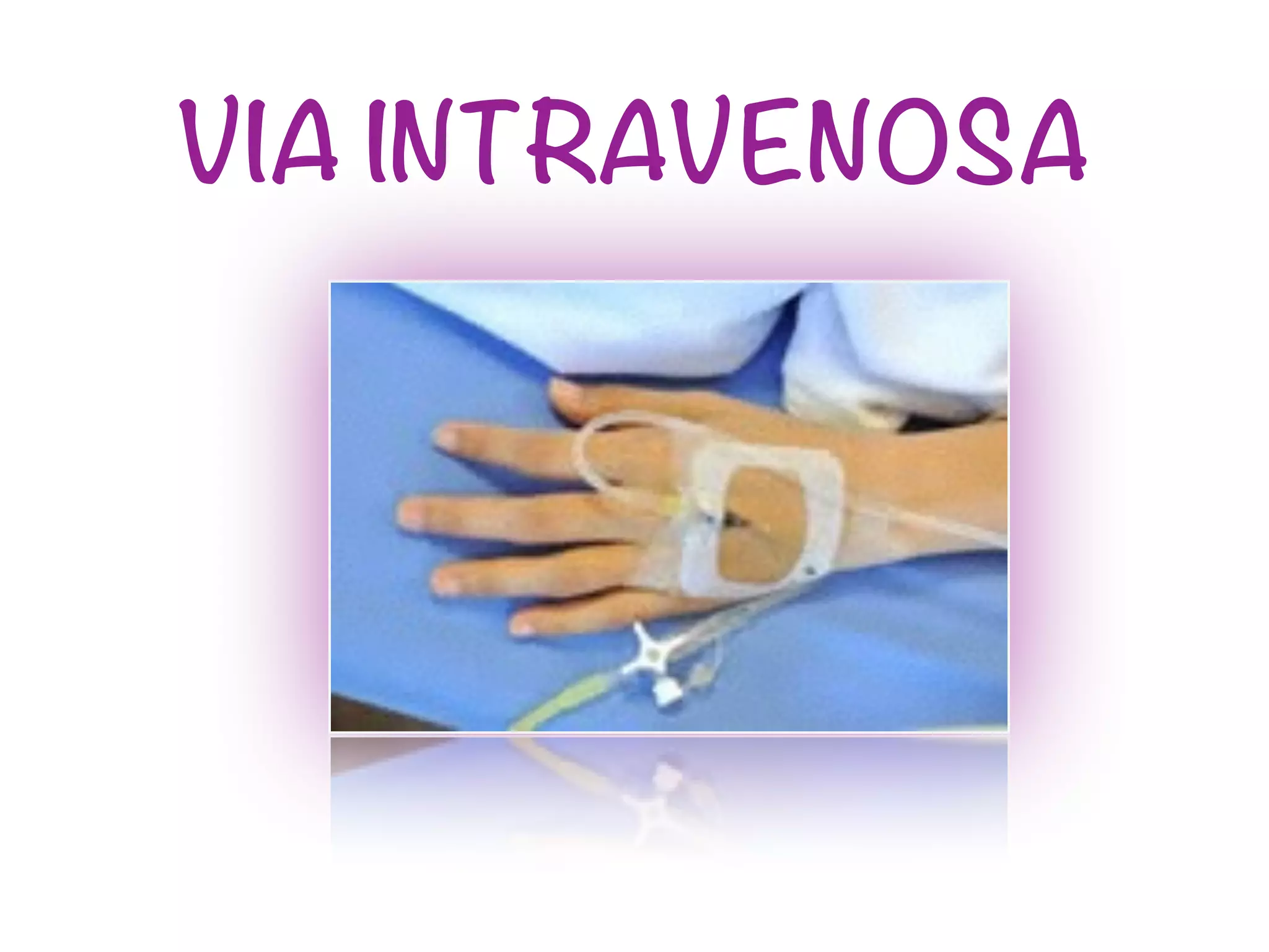 VIA INTRAVENOSA
 