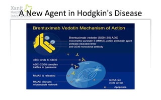 A New Agent in Hodgkin's Disease
 