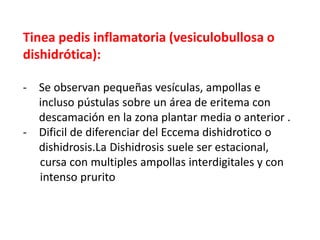 Tinea pedis inflamatoria (vesiculobullosa o
dishidrótica):
- Se observan pequeñas vesículas, ampollas e
incluso pústulas sobre un área de eritema con
descamación en la zona plantar media o anterior .
- Dificil de diferenciar del Eccema dishidrotico o
dishidrosis.La Dishidrosis suele ser estacional,
cursa con multiples ampollas interdigitales y con
intenso prurito
 
