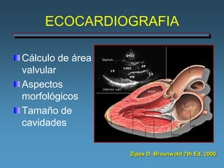 ECOCARDIOGRAFIA

Cálculo de área
valvular
Aspectos
morfológicos
Tamaño de
cavidades


                  Zipes D. Braunwald 7th Ed. 2006
 
