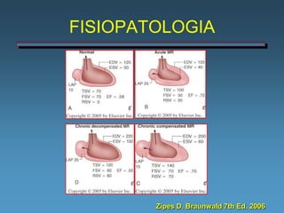 FISIOPATOLOGIA




        Zipes D. Braunwald 7th Ed. 2006
 