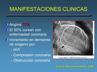 MANIFESTACIONES CLINICAS

Angina 70%
El 50% cursan con
enfermedad coronaria
Incremento en demanda
de oxigeno por:
 - HVI
 - Compresión coronaria
 - Obstrucción coronaria
                           Zipes D. Braunwald 7th Ed. 2006
 