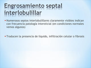 • Numerosos septos interlobulillares claramente visibles indican
con frecuencia patología intersticial (en condiciones normales
vemos algunos)
• Traducen la presencia de líquido, infiltración celular o fibrosis
 