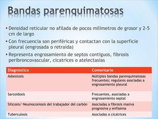 • Densidad reticular no afilada de pocos milímetros de grosor y 2-5
cm de largo
• Con frecuencia son periféricas y contactan con la superficie
pleural (engrosada o retraída)
• Representa engrosamiento de septos contiguos, fibrosis
peribroncovascular, cicatrices o atelectasias
Diagnóstico Comentario
Asbestosis Múltiples bandas parenquimatosas
frecuentes; regulares asociadas a
engrosamiento pleural
Sarcoidosis Frecuentes, asociadas a
engrosamiento septal
Silicosis/ Neumoconiosis del trabajador del carbón Asociadas a fibrosis masiva
progresiva y enfisema
Tuberculosis Asociadas a cicatrices
 