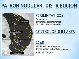 PERILINFÁTICOS
.Sarcoidosis
.Linfangitis carcinomatosa
.Silicosis / Neumoconiosis
CENTROLOBULILLARES
AZAR
.Metástasis hematógenas
.Diseminación miliar tuberculosa
.Infección fúngica
 