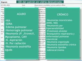 DD del patrón en vidrio deslustrado
AGUDO
-NIA
-SDRA
-Edema pulmonar
-Hemorragia pulmonar
-Neumonía (P. Jirovecii,
Mycoplasma, CMV
-N. Aspiración
-N. Por radiación
-Neumonía eosinófila
aguda
CRÓNICO
-Neumonías intersticiales
(NINE, NID)
-Neumonitis por
hipersensibilidad
-Proteinosis alveolar
-Bronquiolitis respiratoria y
enfermedad pulmonar
intersticial
-Neumonía organizada
-Neumonía eosinófila crónica
-Neumonía lipoidea
-Adenocarcinoma
 