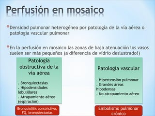 *Densidad pulmonar heterogénea por patología de la vía aérea o
patología vascular pulmonar
*En la perfusión en mosaico las zonas de baja atenuación los vasos
suelen ser más pequeños (a diferencia de vidrio deslustrado!)
Patología
obstructiva de la
vía aérea
. Bronquiectasias
. Hipodensidades
lobulillares
. Atrapamiento aéreo
(espiración)
Patología
obstructiva de la
vía aérea
. Bronquiectasias
. Hipodensidades
lobulillares
. Atrapamiento aéreo
(espiración)
Patología vascular
. Hipertensión pulmonar
. Grandes áreas
hipodensas
. No atrapamiento aéreo
Patología vascular
. Hipertensión pulmonar
. Grandes áreas
hipodensas
. No atrapamiento aéreo
Embolismo pulmonar
crónico
Bronquiolitis constrictiva,
FQ, bronquiectasias
 