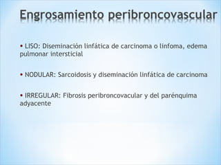 • LISO: Diseminación linfática de carcinoma o linfoma, edema
pulmonar intersticial
• NODULAR: Sarcoidosis y diseminación linfática de carcinoma
• IRREGULAR: Fibrosis peribroncovacular y del parénquima
adyacente
 