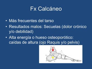 Fx Calcáneo
• Más frecuentes del tarso
• Resultados malos: Secuelas (dolor crónico
y/o debilidad)
• Alta energía o hueso osteoporótico:
caídas de altura (ojo Raquis y/o pelvis)
 