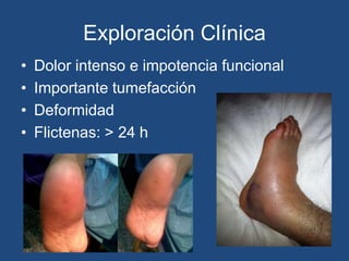 Exploración Clínica
• Dolor intenso e impotencia funcional
• Importante tumefacción
• Deformidad
• Flictenas: > 24 h
 