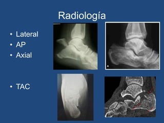 Radiología
• Lateral
• AP
• Axial
• TAC
 
