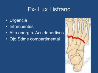 Fx- Lux Lisfranc
• Urgencia
• Infrecuentes
• Alta energía. Acc deportivos
• Ojo Sdme compartimental
 