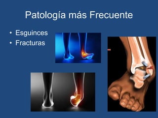 Patología más Frecuente
• Esguinces
• Fracturas
 