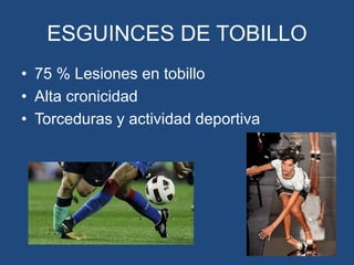 ESGUINCES DE TOBILLO
• 75 % Lesiones en tobillo
• Alta cronicidad
• Torceduras y actividad deportiva
 