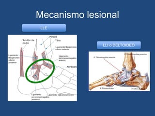 Mecanismo lesional
LLE
LLI o DELTOIDEO
 