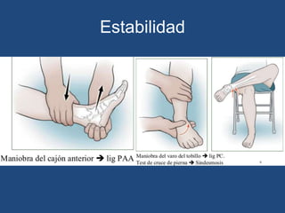 Estabilidad
 