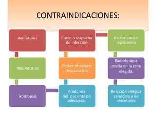 CONTRAINDICACIONES:CONTRAINDICACIONES:
 