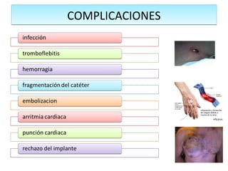 COMPLICACIONESCOMPLICACIONES
 