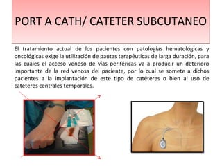 PORT A CATH/ CATETER SUBCUTANEOPORT A CATH/ CATETER SUBCUTANEO
El tratamiento actual de los pacientes con patologías hematológicas y
oncológicas exige la utilización de pautas terapéuticas de larga duración, para
las cuales el acceso venoso de vías periféricas va a producir un deterioro
importante de la red venosa del paciente, por lo cual se somete a dichos
pacientes a la implantación de este tipo de catéteres o bien al uso de
catéteres centrales temporales.
 