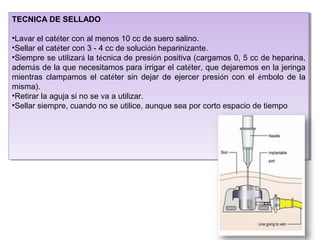 TECNICA DE SELLADO
•Lavar el catéter con al menos 10 cc de suero salino.
•Sellar el catéter con 3 - 4 cc de solución heparinizante.
•Siempre se utilizará la técnica de presión positiva (cargamos 0, 5 cc de heparina,
además de la que necesitamos para irrigar el catéter, que dejaremos en la jeringa
mientras clampamos el catéter sin dejar de ejercer presión con el émbolo de la
misma).
•Retirar la aguja si no se va a utilizar.
•Sellar siempre, cuando no se utilice, aunque sea por corto espacio de tiempo
TECNICA DE SELLADO
•Lavar el catéter con al menos 10 cc de suero salino.
•Sellar el catéter con 3 - 4 cc de solución heparinizante.
•Siempre se utilizará la técnica de presión positiva (cargamos 0, 5 cc de heparina,
además de la que necesitamos para irrigar el catéter, que dejaremos en la jeringa
mientras clampamos el catéter sin dejar de ejercer presión con el émbolo de la
misma).
•Retirar la aguja si no se va a utilizar.
•Sellar siempre, cuando no se utilice, aunque sea por corto espacio de tiempo
 